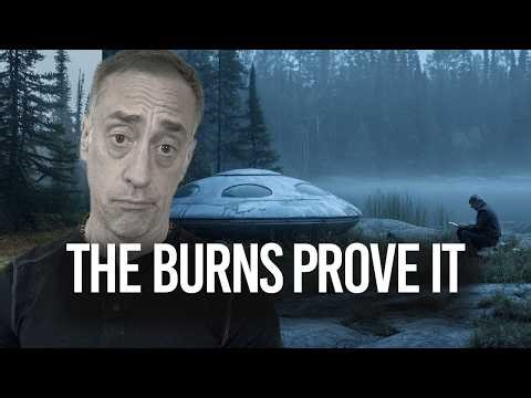 Ep. 60 | The Man Who Touched A UFO And Has The Burns To Prove It |Mostly True Alien Stories