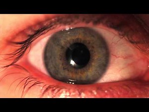 The eye shows the first concept to understand Aperture