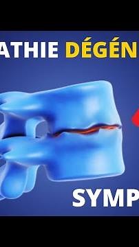 Here are the 3 main symptoms of degenerative disc disease