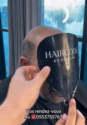 Installation de prothèses capillaires à Oran