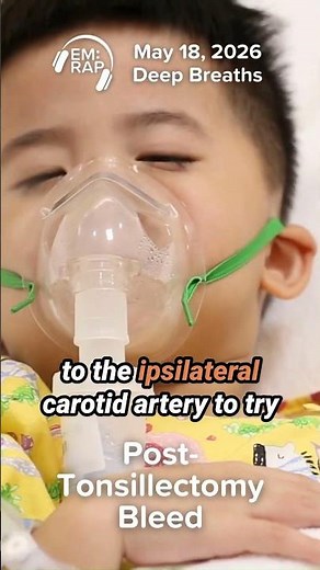 Post-Tonsillectomy Bleed