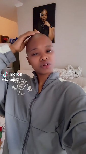 Embrace Baldness: The Bald Baddie Movement Explained