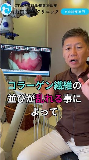 健康な歯茎の証！#歯肉 #ぶつぶつ #歯周病 #恵比寿 #歯医者