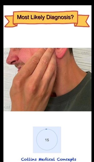 MOST LIKELY DIAGNOSIS #1: Pattern Recognition Challenge | Jaw Pain #medicalquiz