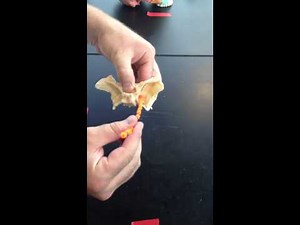 Sphenoid Bone