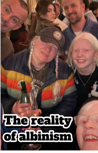 I always like to keep things positive and celebrate albinism and the achievements of people with albinism, sharing what life is like. But sometimes you also need to be honest and talk about the times when life isn’t always easy. In this video from the Albinism Fellowship Carol Concert, I share a little bit about the reality of albinism sometimes. #albinism #fyp #christmas #Disability #albino