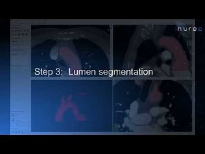Tutorial semi automatic segmentation using ITK-SNAP (31/10/2025)