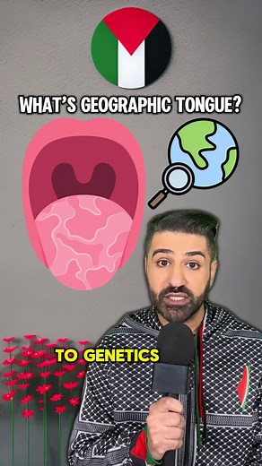 Understanding Geographic Tongue: Causes and Facts