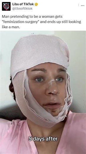 922K views · 16K reactions | Man pretending to be a woman gets "feminization surgery" and ends up still looking like a man. | Libs of Tik Tok | Facebook