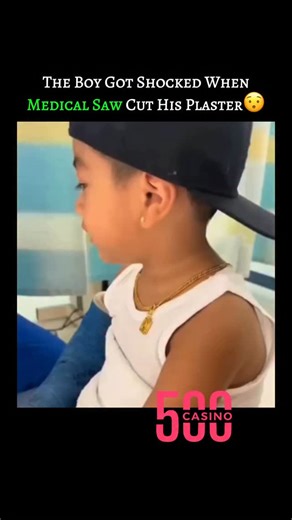 Medical | Science | Facts on Instagram: "A medical cast saw uses an oscillating blade that moves back and forth very rapidly, rather than spinning. This motion allows it to cut through hard, rigid materials like plaster or fiberglass, which resist movement and get abraded. However, soft tissues like skin can move with the blade’s vibrations, so they absorb the motion without being cut. This clever design makes it safe for removing casts without injuring the patient.😳 . . . #trendingreels #didyo