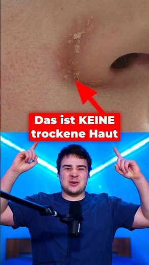 Du hast wahrscheinlich KEINE trockene Haut