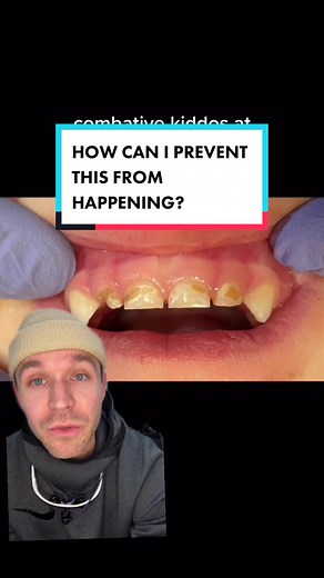 Happy Tooth on TikTok