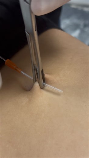 The Piercing Places | Fremantle WA on Instagram: "With summer just around the corner, there’s no better time to get a navel piercing — provided your anatomy is right for it. ✨ - - - #goldjewellery #Bodymod #traguspiercing #bellybuttonpiercing #helix #lobepiercings #earstack #Thepiercingplaces #Fremantle #aclassabovetherest #Bodypiercing #Piercinggoals #PIercingstudioperth #bodypiercingperth #piercingoftheday #fyp #fyppiercing #piercinglove #curatedlook #piercinginspo #modifiedandproud #industria