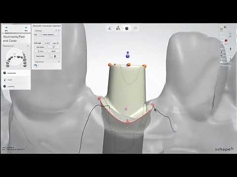 Dental Lab Life: Designing an Abutment in 3Shape