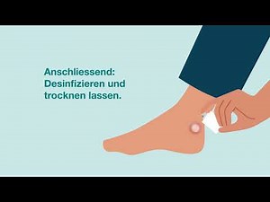 iMpuls: Was tun bei Blasen an den Füssen?