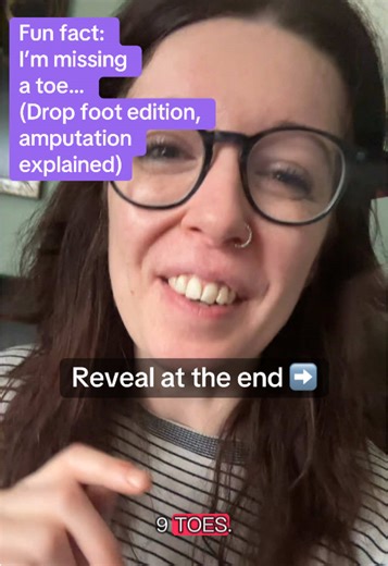 Partial amputation of my drop foot/insensate foot. This is what happened when we ignored the repeat infections on the side of my foot for years. I'm just glad I've still got my leg! #nervedamage #partytrick #littletoe #boneinfection