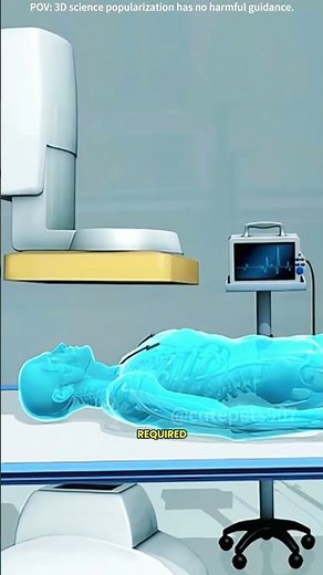 Atherectomy procedure to clear blocked arteries 3D animation #drone #theflash #space #voluson