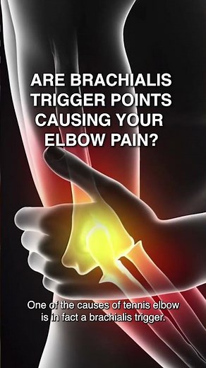 Are Brachialis Trigger Points Causing your Elbow Pain?