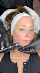 Photoshoot skin prep with a glow-up from my go-to skin queen, @bellatox.sarah at BellaTox Boutique! ✨ We did a @hydrafacial which is the ultimate skin reset. It’s a multi step treatment that cleanses, extracts, and hydrates using patented technology. Basically, it clears out pores, removes dead skin, and infuses nourishing serums all in one noninvasive treatment. No downtime, just instantly smoother, brighter, dewy skin — perfect before a photoshoot or big event. Sarah’s touch is literally magic