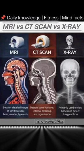 #trollface #viralboy #fyp #trend