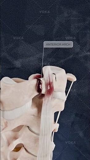 How do anterior and posterior arch C1 fractures affect spinal stability? Explained in 3D