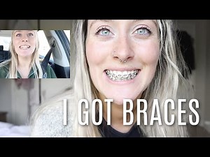 i got braces for the first time!! (adult braces / braces at 26)