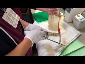 How to back fill a bladder