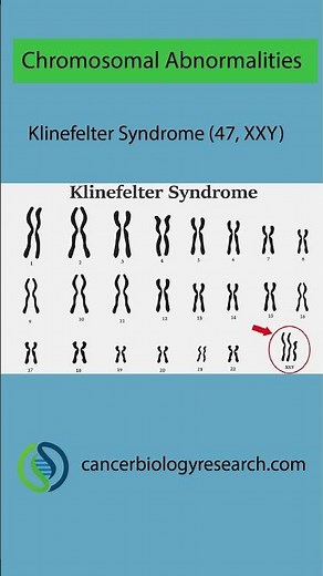 Chromosomal Abnormalities #biology #science #anatomy