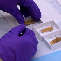 Video: High-Speed Human Temporal Bone Sectioning for the Assessment of COVID-19-Associated Middle Ear Pathology