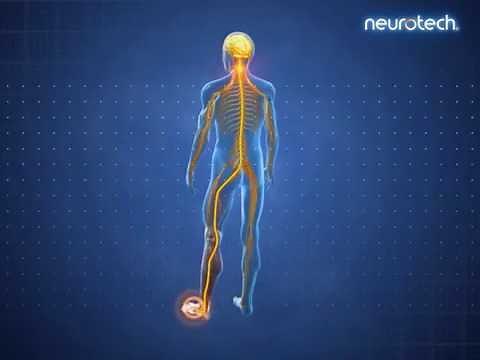 Wirkweise TENS 1: Pain Gate (Schmerztor)
