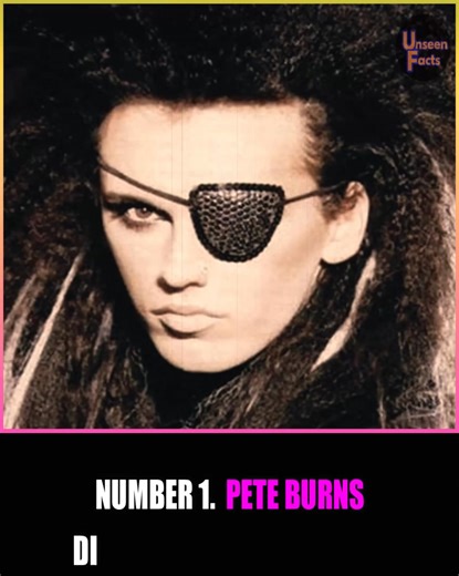 Remembering Pete Burns, Dead or Alive singer, who died of cardiac arrest in 2016 at 57. #reels #reels2025 #peteburns #deadoralive #surgery #youspinmeround #musician | Unseen Facts Compilations