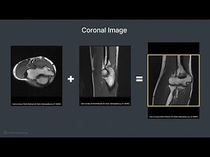 Patient Positioning and Protocol for an Elbow MRI