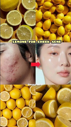 Benefits of Fruits for Skin 🍓✨ | Natural Glow & Clear Skin Secrets