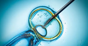 The advantages and disadvantages of IVF Treatment
