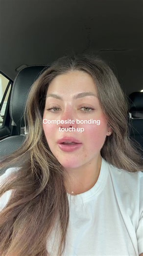 My teeth have become one of my favorite things about me now! Thank you as always, @miamidentalspa #compositebonding #veneers #fyp #glowuptips #compositeveneers