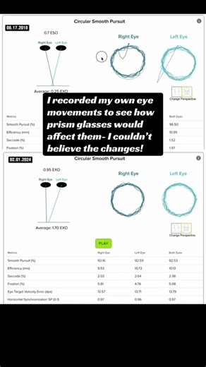 I recorded my own eye movements to see how prism glasses actually change visual function and the