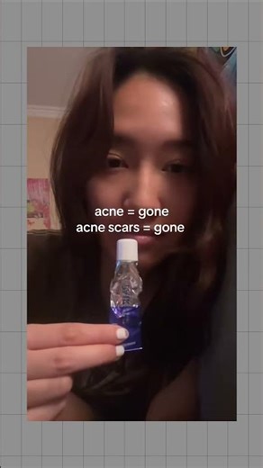 highly recommend!#acne #acnecream #lionpairacnecream #lionpaircream #...