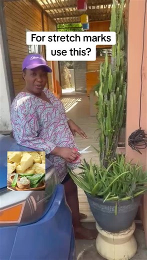 Aloe Vera and Shea Butter for Stretch Marks