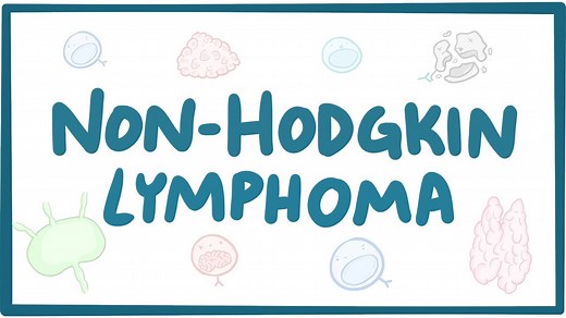 Non-Hodgkin lymphoma: Video, Causes, & Meaning | Osmosis