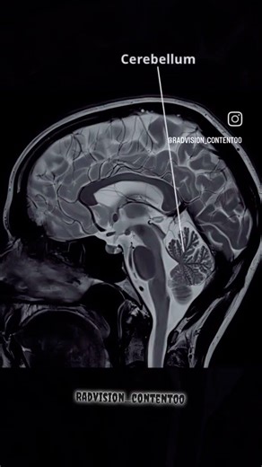 #neuroscience #brainscience #brain #medicine #health #neurociencia #science #brainhealth #neurology