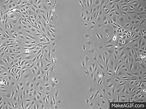HUVEC wound healing/migraion assay on Make a GIF