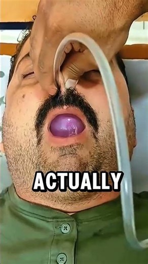 Why Doctors Use Balloons For Nose Surgery.