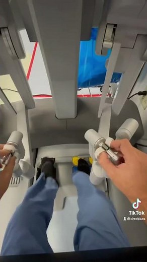 How I perform a robotic sleeve gastrectomy ￼