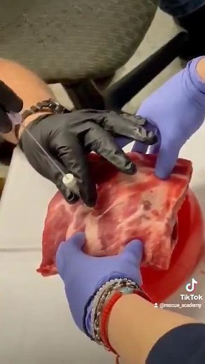 Needle decompression demonstration in paramedic school!