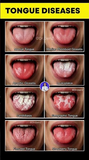 7 Tongue Problems That Signal Hidden Disease 😱
