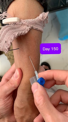 Day 150: 22G IV Cannula Insertion in Distal Forearm Vein 💉 #Shorts#viralshorts #viralreels #safi