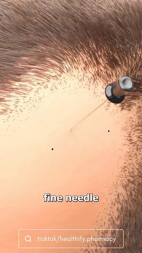 Capilus Hair Oil, hair growth oil, anti hair fall oil, best hair oil for hair growth, | Capillus Oil