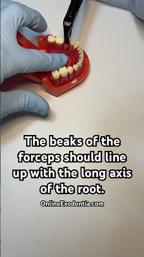 Dental Forceps Used Properly For Tooth Extraction 🦷 | OnlineExodontia.com | #oralsurgery