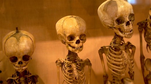 Frankenschau aktuell: Uni Erlangen untersucht dunkles Kapitel der Anatomie