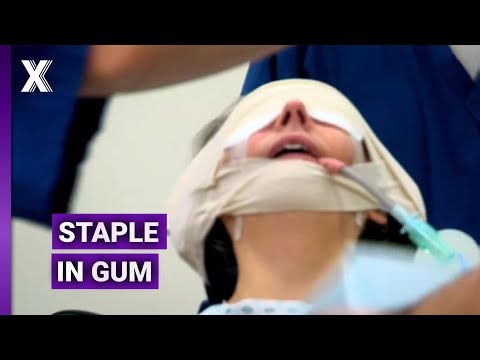Karaoke Knife Stab and Staple in Gum ER Cases | Bizarre ER